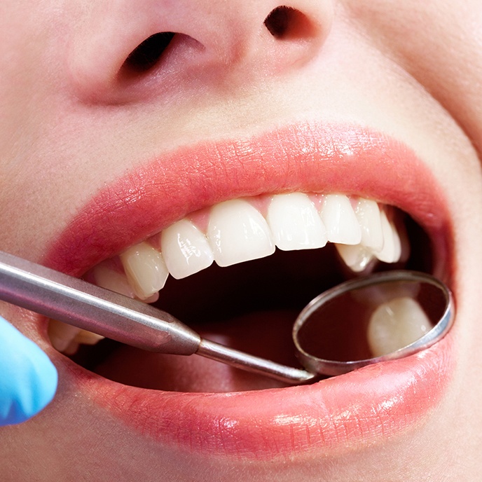 Dentist checking patient's smile during tooth colored filling restorative dentistry