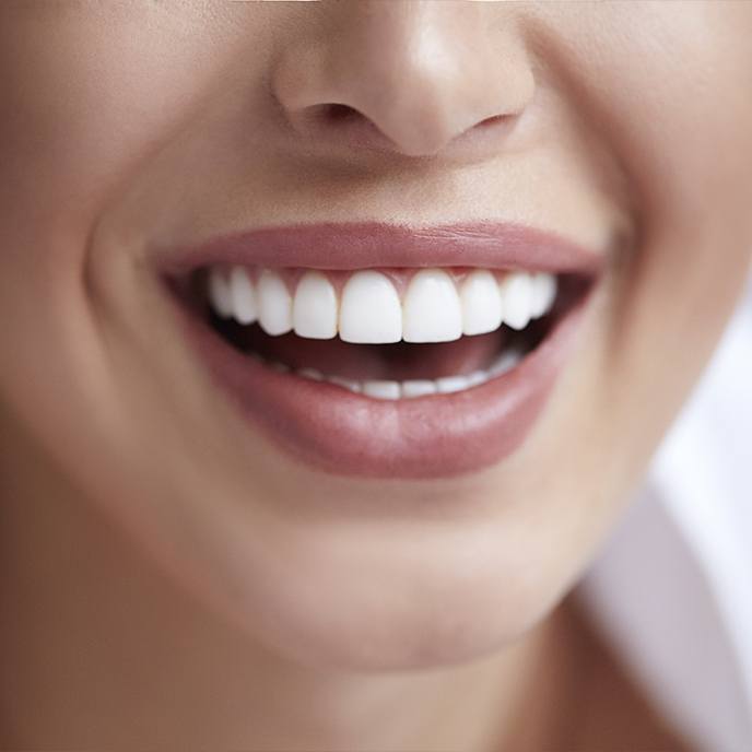 Closeup of flawless smile after porcelain veneers and cosmetic dentistry
