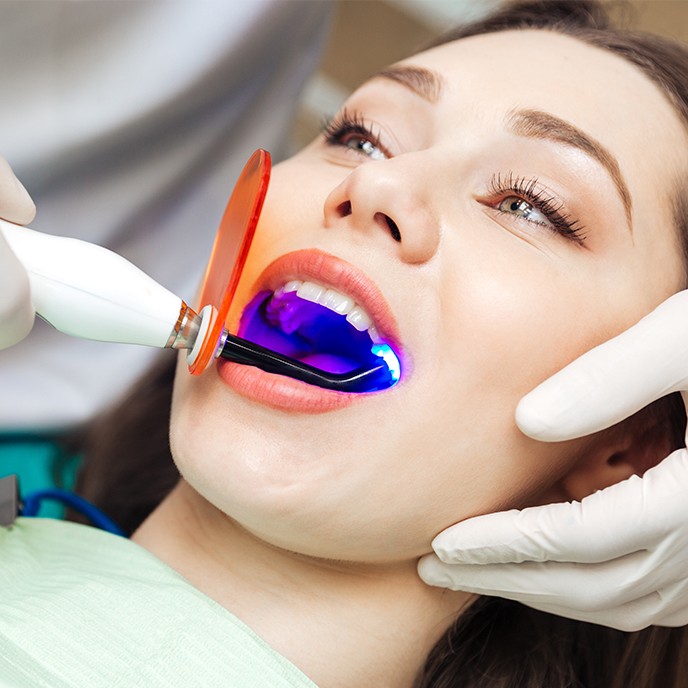 Closeup of smile during cosmetic dental bonding treatment