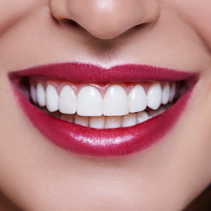 Closeup of smile after teeth whitening