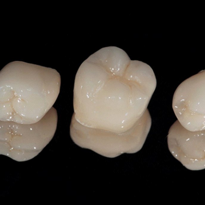 Three dental crowns on black background