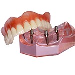 Implant supported denture on white background