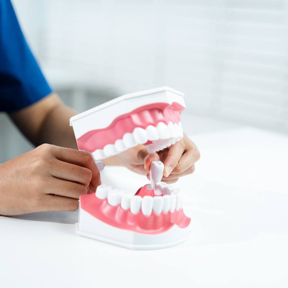 Dental assistant showing tooth extraction on model of mouth