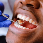 man getting a dental exam and enjoying the long-term benefits of dental implants