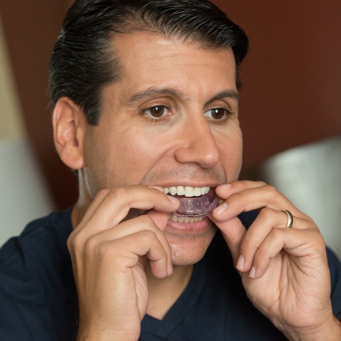 Man placing an oral appliance for sleep apnea