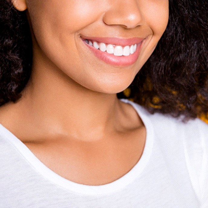 An up-close view of a woman’s smile after receiving veneers in St. Johns