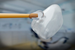 a closeup of a dental veneer