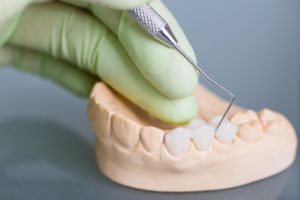 a dentist showing a dental bridge on a set of replica teeth