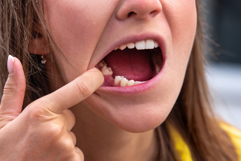 A young woman with a missing tooth