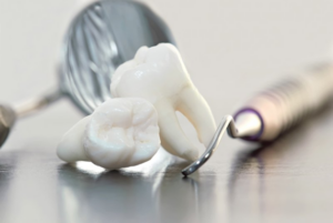 Close up of two wisdom teeth next to dental mirror and pick